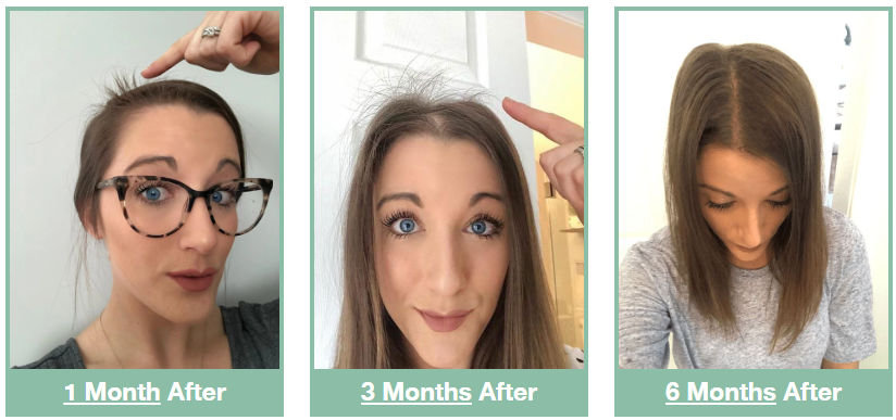 EverBella Complete Biotin Plus Benefits