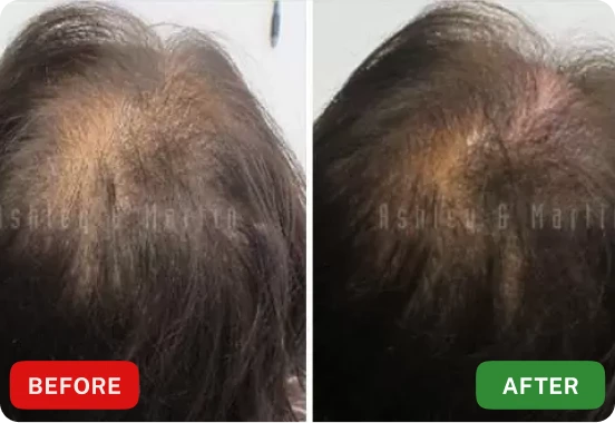 Roota Hair Growth Serum Customer Review 1