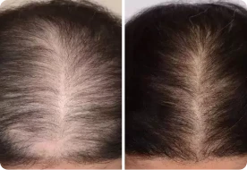Roota Hair Growth Serum Customer Review 2
