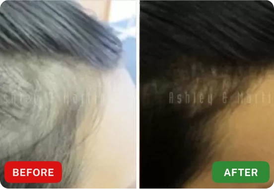 Roota Hair Growth Serum Customer Review 3