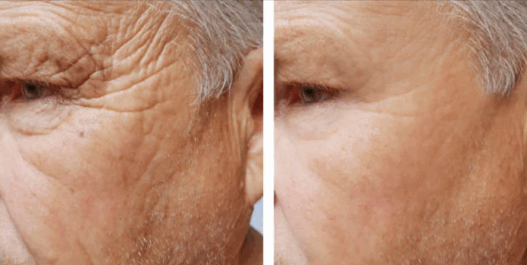 VYNE-Anti-Aging-Serum-Benefits