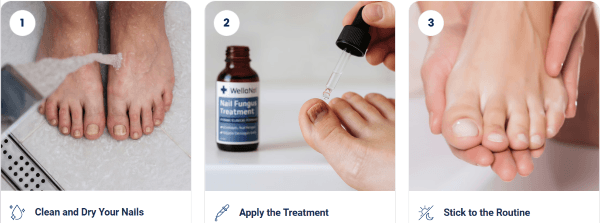 WellaNail Fungus Treatment Oil how to use