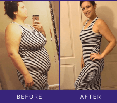 KetoNex Gummies Australia Before After